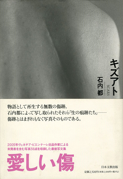 「写真文集 キズアト」石内都